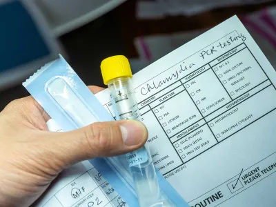 A patient holds a sample test tube for Chlamydia testing.