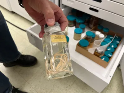 A jar containing Ascaris, a parasitic worm that affects over one billion people worldwide